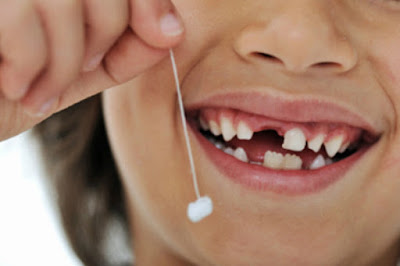 Những lưu ý khi nhổ răng trẻ em Những lưu ý khi nhổ răng trẻ em