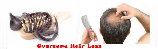 How To Fix Hair Loss Naturally