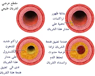 الكوليستيرول الصديق والكوليسترول العدو