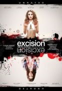 excision