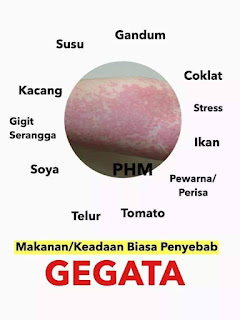 Tips Cara Hilangkan Kelopak Garam Gegata Alergi Gatal Badan