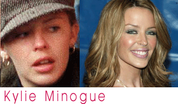 Hollywood Celebrities Without Makeup Pics