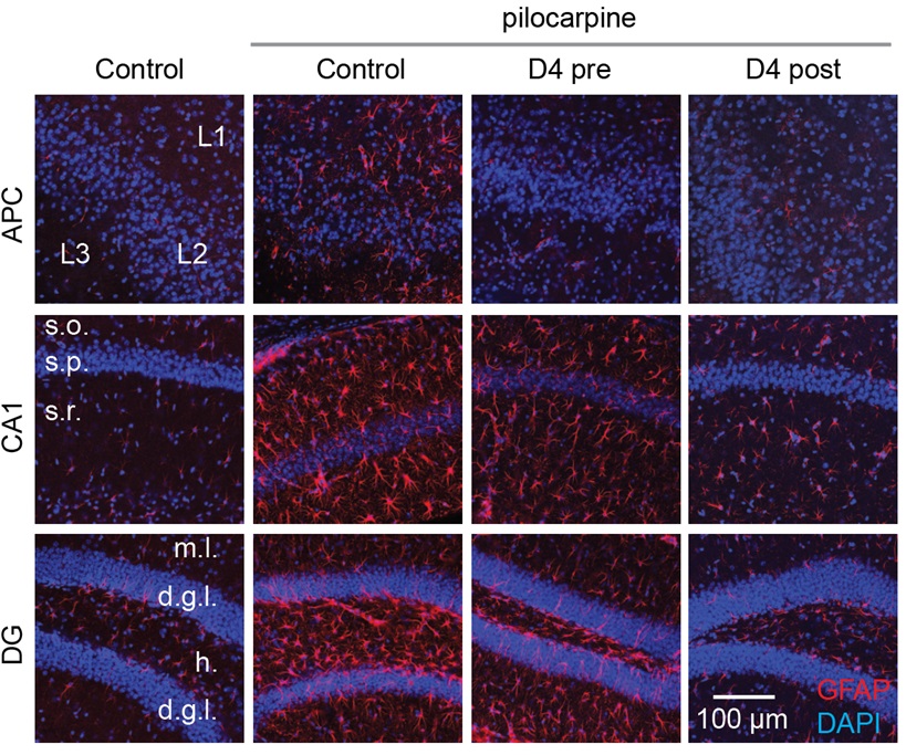 New drug D4 suppresses neuroinflammation