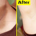 Whiten Dark Underarms Instantly  Remove Unwanted Body Hair  100% Natural