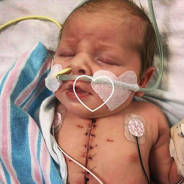 Baby Born With Hypoplastic Left Heart Syndrome, Congenital Heart Defect Off From Oxygen.