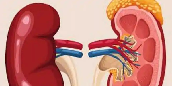 Kidney Cancer | വൃക്കയിലെ അര്‍ബുദത്തെ സൂക്ഷിക്കുക, ജീവന് തന്നെ ഭീഷണിയാണ്; ഈ ലക്ഷണങ്ങള്‍ ഒരിക്കലും അവഗണിക്കരുത്