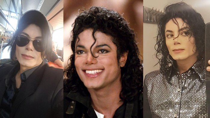  Pria Ini Rela Operasi Berkali-kali Demi Mirip Michael Jackson