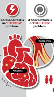 Heart attack vs cardiac arrest