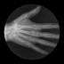 Fantástico: GIFs de Raios X mostram articulações em movimento