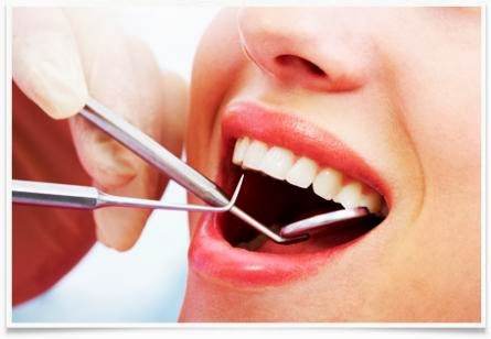 Cara Menghilangkan Karang Gigi