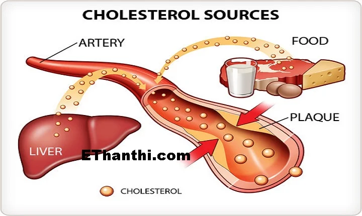 கொலஸ்ட்ராலைக் குறைக்கும்