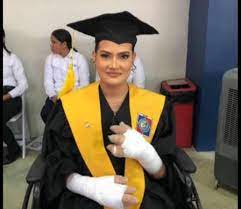 Se gradúa como Licenciada en Medicina joven se le quemaron las manos cuando intentaba salvar a su hijo en carnaval de Salcedo