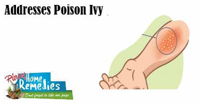 10 Amazing Uses Of Rubbing Alcohol: Poison Ivy