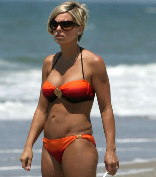 kate gosselin tummy tuck