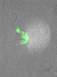 carbon nanotubes to monitor chemotherapy