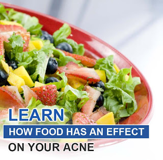 Learn How Food Has an Effect on Your Acne