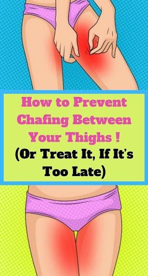 How to Prevent Thigh Chafing this Summer