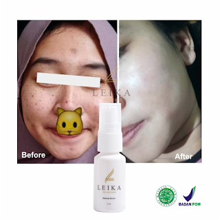 Testimoni glowing serum leika