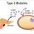 Avoid Type 2 Diabetes. It Is Preventable