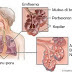  Pengertian dan Penyebab Penyakit - Pengertian penyakit Emfisem, Penyebab, Gejala dan Pencegahan- TodaysDandy
