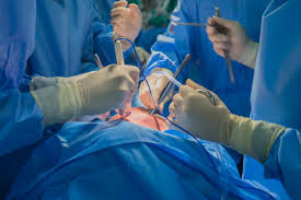 Essential Recovery Tips After Heart Surgery