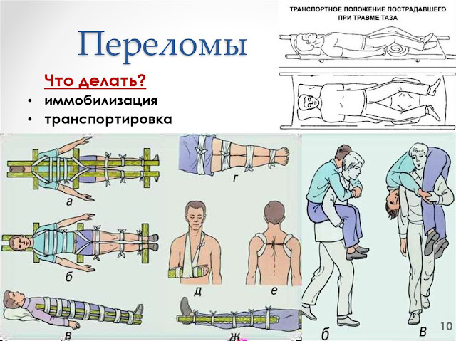 Первая помощь при травмах