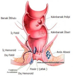  OBAT WASIR