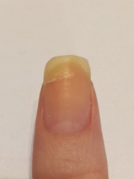 Moru S Nails ありえない亀裂