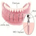 Trồng răng implant giá khoảng bao nhiêu tiền ?