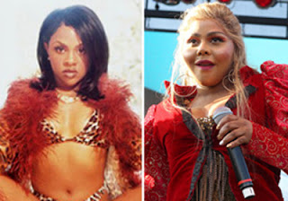 Lil Kim Plastic Surgery