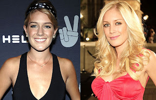 Heidi Montag Plastic Surgery