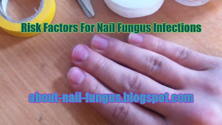 Risk Factors For Nail Fungus Infections