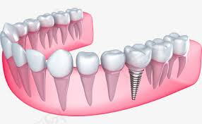 modèle orthodontie