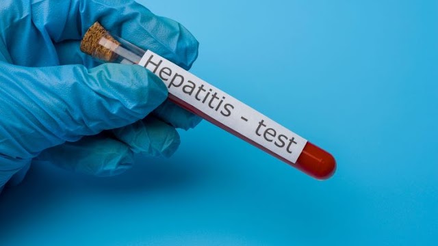 País reporta 14 casos de hepatitis A 