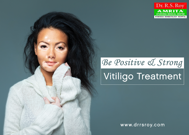 http://drrsroy.com/vitiligo.html