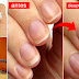 DIY - How To Grow Nails Faster In A Week!