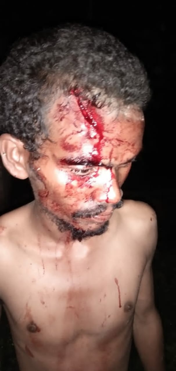 उन्नाव: मुहल्ले के युवकों ने एक युवक को अगवा कर किया मरणासन्न
