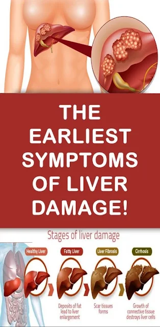The Earliest Symptoms Of Liver Damage!