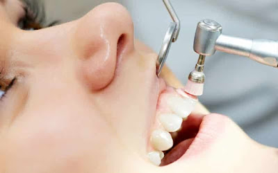 Viêm lợi sưng chân răng có nguy hiểm không? 2