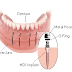 Kerela Healthcare Holidays: All types of dental treatment at the right price