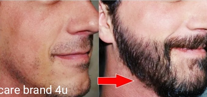 How to Fix Patchy beard naturally & Saving Tips