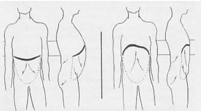 Diaphragmatic Breathing