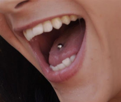Un piercing de lengua puede provocar huecos entre los dientes como 