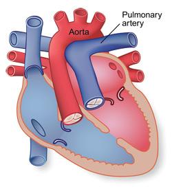 Difference between pulmonary artery and pulmonary vein