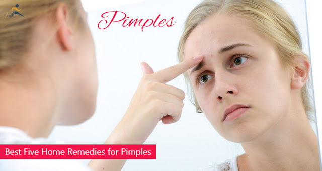 कील मुहासे का उपचार -,Home Treatment for Pimples and Acne in Hindi,