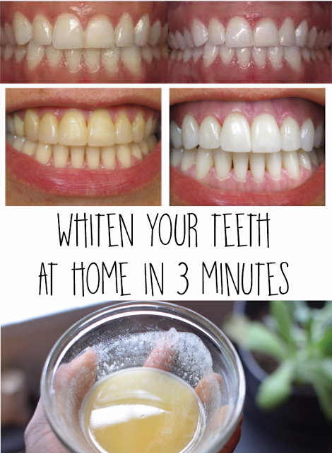 Creative Ideas: Whiten your teeth at home in 3 minutes