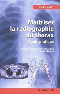 Maîtriser la radiographie du thorax : Guide pratique