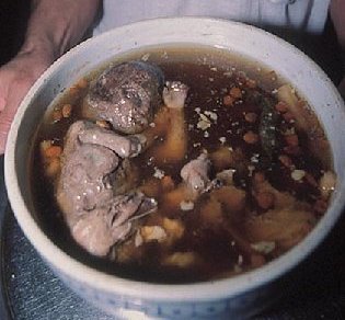 sup dari janin manusia