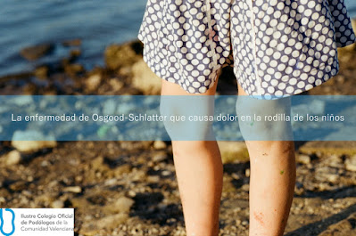 La enfermedad de Osgood-Schlatter que causa dolor en la rodilla de los niños