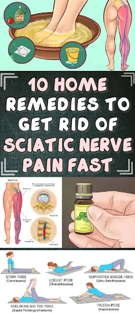 10 Best Home Remedies To Get Rid of Sciatic Nerve Pain